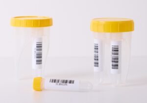 TUBYCON Launches “Dual Urine Cup” – One Collection, Two Samples