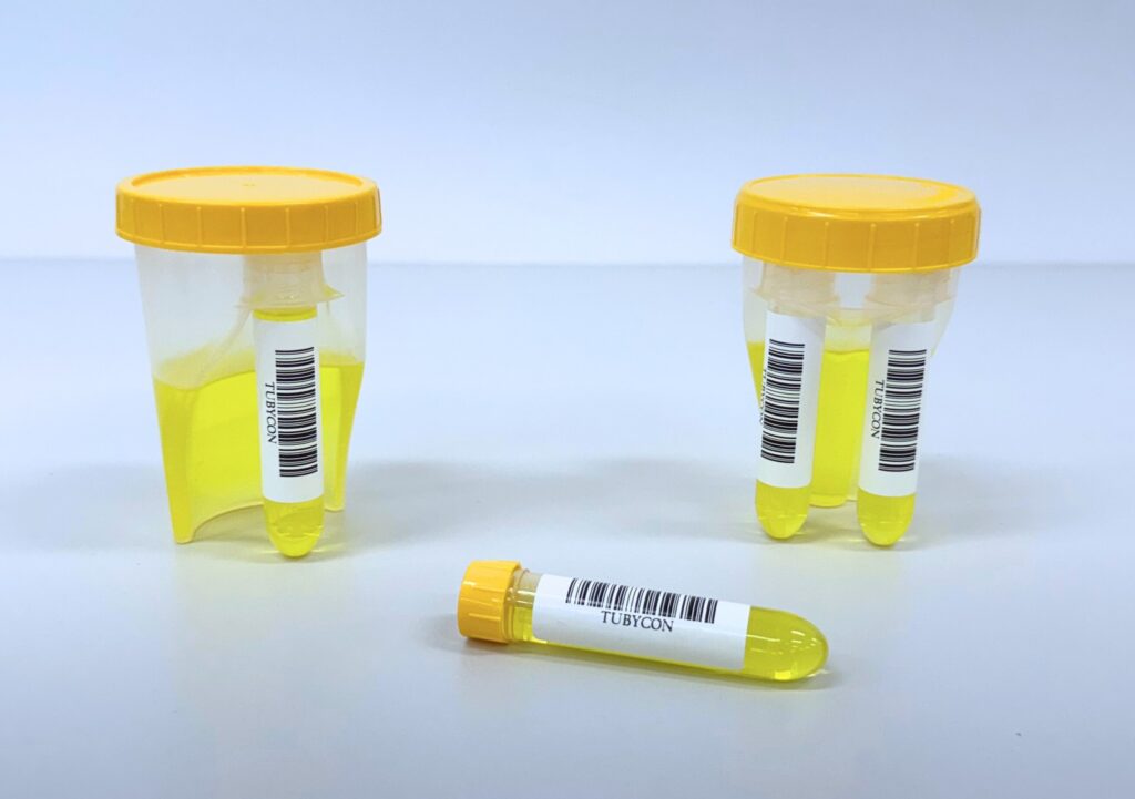 mage of the TUBYCON-U2 dual urine cup 2