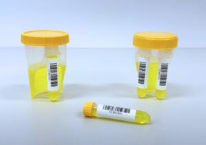 TUBYCON Launches “Dual Urine Cup” – One Collection, Two Samples