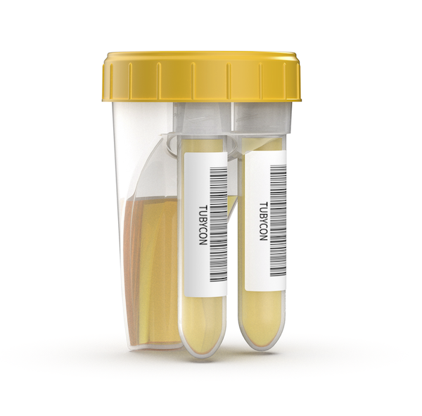 Tubycon’s new dual urine cup product image 3