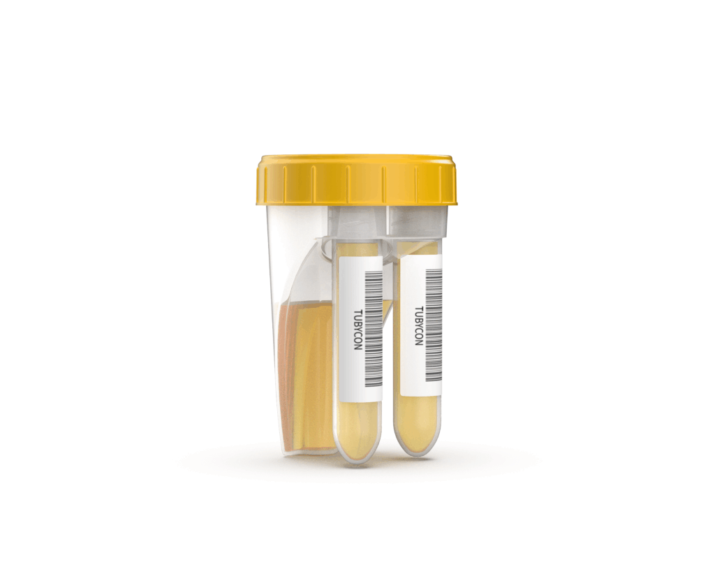 Tubycon’s new dual urine cup product image3