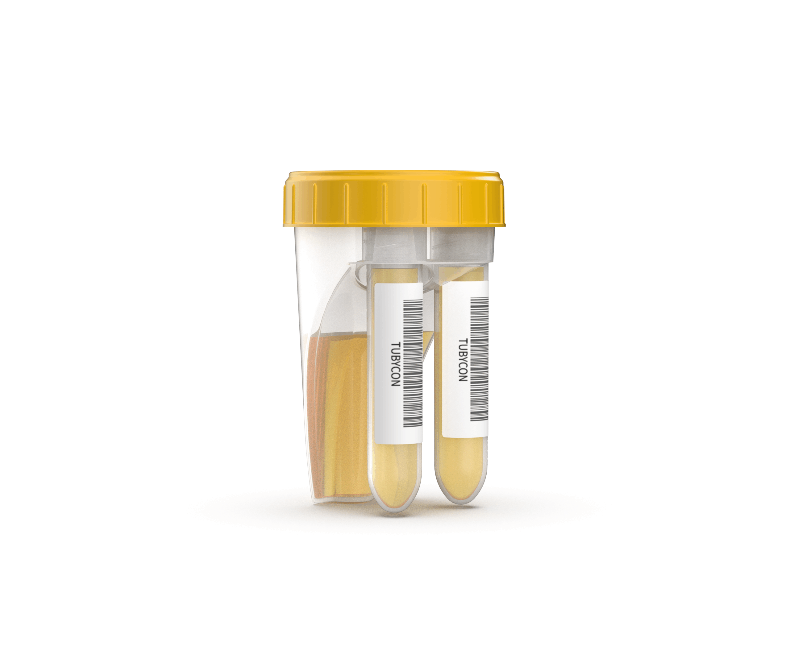 Read more about the article TUBYCON Launches “Dual Urine Cup” – One Collection, Two Samples