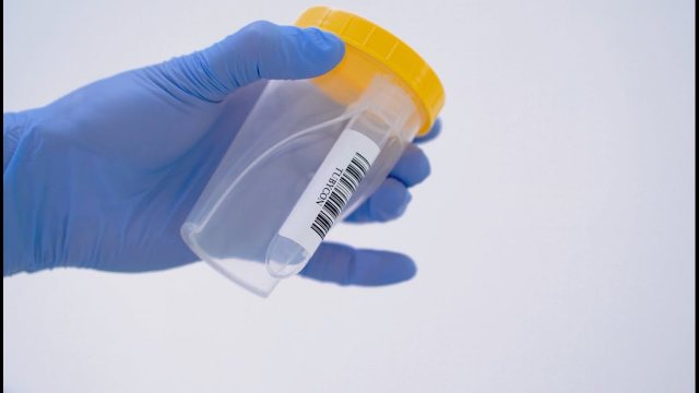 All-in-One Urine Cup TUBYCON-U video thumbnail