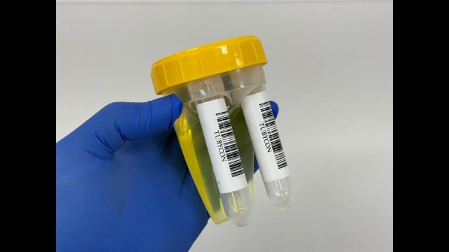 Dual Urine Cup video thumbnail