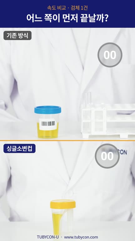 검체 1건 · 기존 방식 vs 싱글소변컵 영상 표지